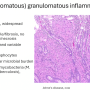 lepromatous_inflammation.png