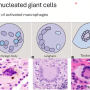 giant_cells.png