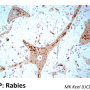 rabies_intracytoplasmic_replication.png