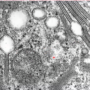 birbeck_granules.png