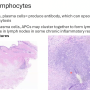 tertiary_lymphoid_structures.png