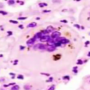 fb_giant_cell.png
