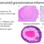 nodular_granulomas.png